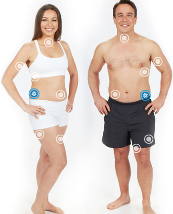 Zones traitées par la cryolipolyse Coolsculpting